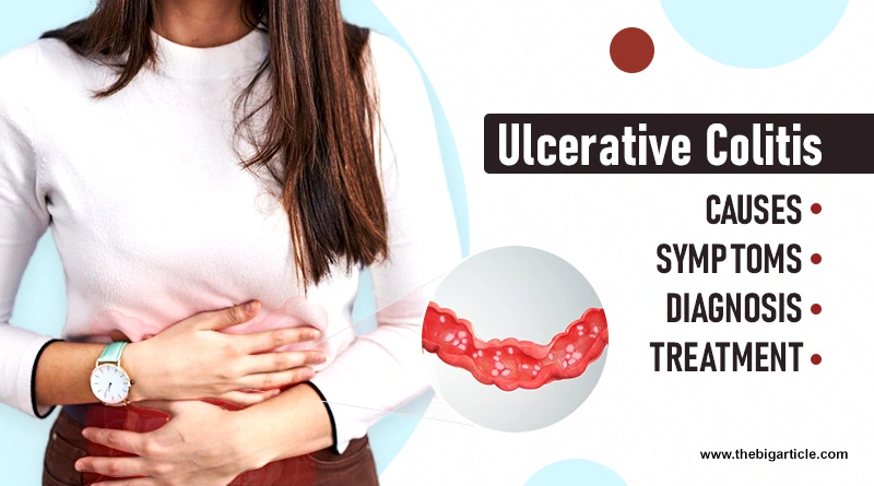 Ulcerative Colitis